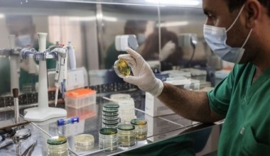 ЖССТ: дунёда вабодан ўлим кўрсаткичи 71 фоизга ошди